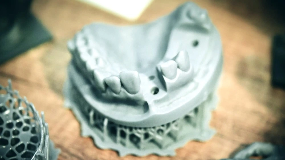 3D-gedrucktes Zahnmodell im Dentallabor – Online-Seminar BEB-Abrechnung Zahntechnik | Spitta Akademie