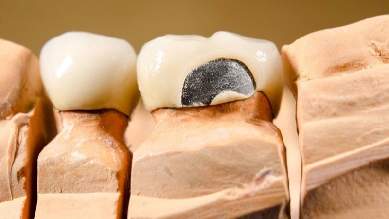Zahntechnikerin hält Gipsmodell unter Artikulator im Dentallabor – Online-Seminar Abrechnung zahntechnischer Leistungen | Spitta Akademie
