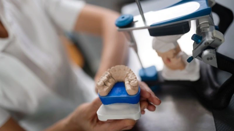 Beschädigte Keramikkrone auf Gipsmodell im Dentallabor – Online-Seminar Abrechnung zahntechnischer Leistungen bei Reparaturen | Spitta Akademie