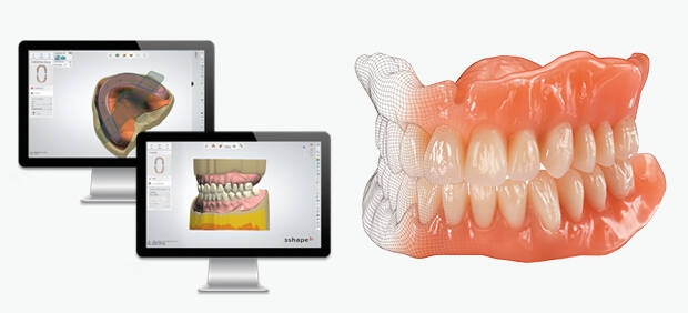 EVO-Denture – ein digitales Highlight in der Totalprothetik EVO-Denture – ein digitales Highlight in der Totalprothetik
