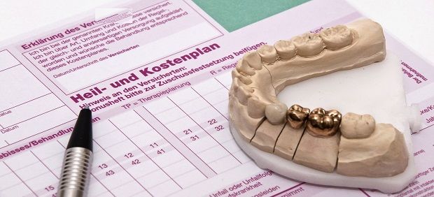 Implantat gestützter Zahnersatz bei Senioren: Die optimale Planung inklusive Genehmigung und Abrechnung Implantat gestützter Zahnersatz bei Senioren: Die optimale Planung inklusive Genehmigung und Abrechnung